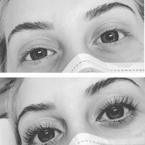 black and white before and after model from gloss lash lounge